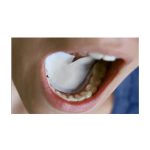 DryDent SubLingual Saliva Absorbent Control